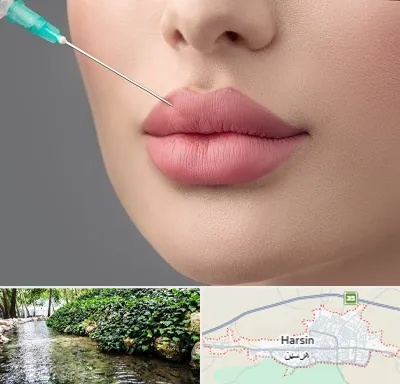 کلینیک ژل لب روسی در هرسین