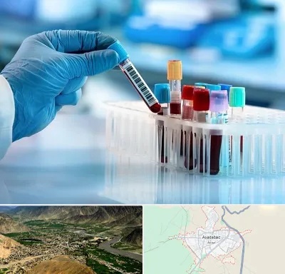 آزمایشگاه خون قبل از ازدواج در اسدآباد