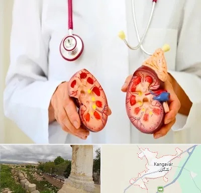دکتر سنگ کلیه در کنگاور