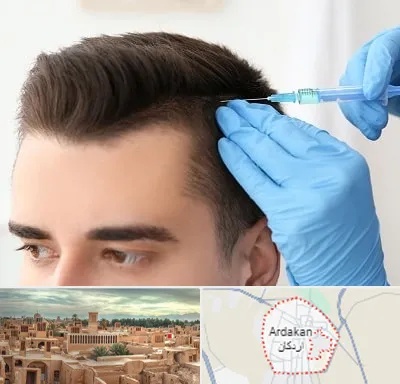 مزوتراپی مو در اردکان