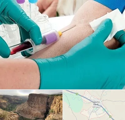 آزمایشگاه در منزل در سرپل ذهاب