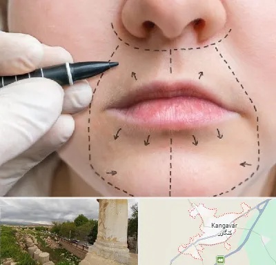 عمل سانترال لب در کنگاور