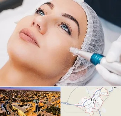 مزونیدلینگ در بافق