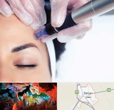 کلینیک مزوتراپی صورت در دلیجان