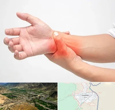 دکتر متخصص دست در اسدآباد