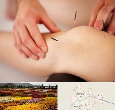 دکتر طب سوزنی برای لاغری در محلات