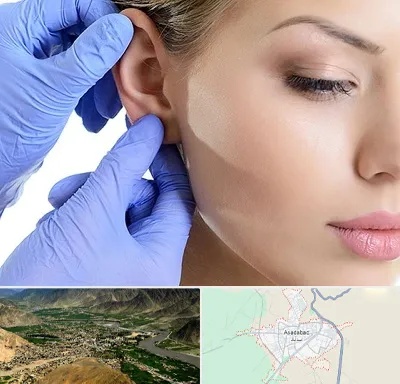 اتوپلاستی در اسدآباد