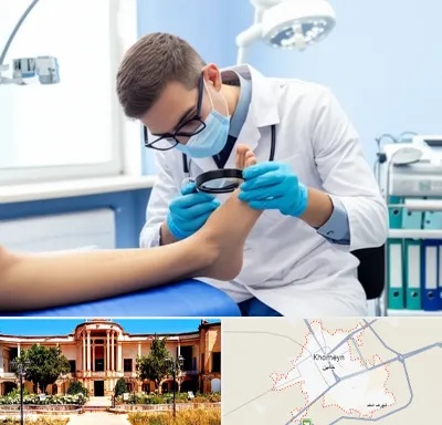 درمان زخم پای دیابتی در خمین