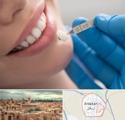 مرکز لمینت دندان در اردکان