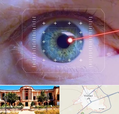 فمتولیزیک در خمین