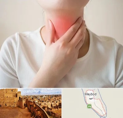 دکتر سرطان مری در میبد