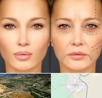 متخصص زیبایی چشم در اسدآباد