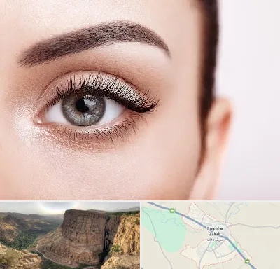 فوق تخصص عنبیه در سرپل ذهاب