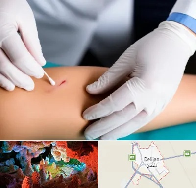 متخصص زخم عفونی در دلیجان