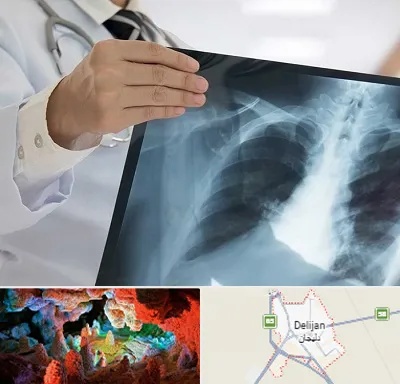 فوق تخصص ریه در دلیجان