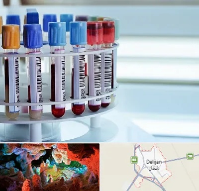 آزمایشگاه ژنتیک در دلیجان