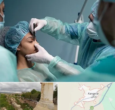 عمل بینی ارزان در کنگاور