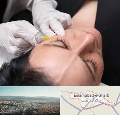 کربوکسی تراپی در اسلام آباد غرب