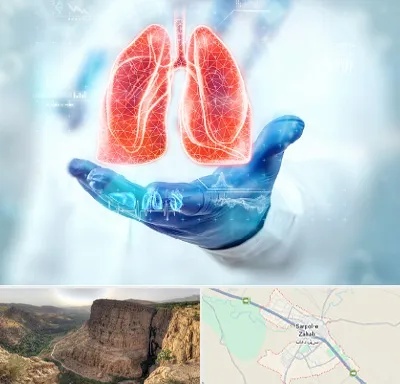 بیمارستان ریه در سرپل ذهاب
