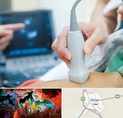 اکو قلب شبانه روزی در دلیجان