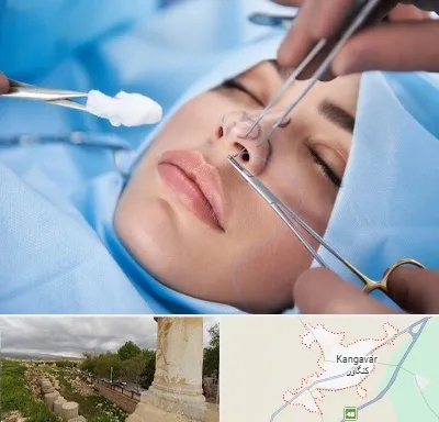 عمل ترمیمی بینی در کنگاور