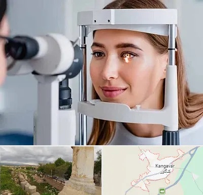 دکتر قوز قرنیه در کنگاور