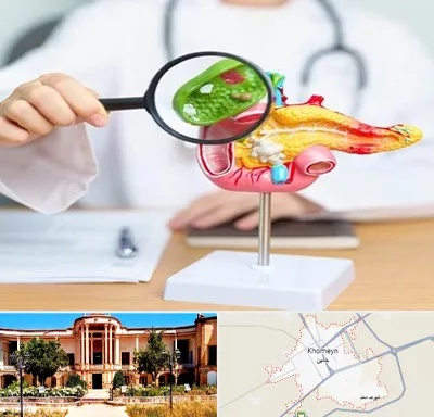 جراح سرطان پانکراس در خمین