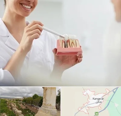 دکتر دندانساز در کنگاور