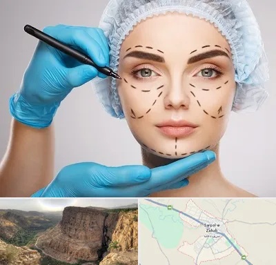 جراح فک و صورت در سرپل ذهاب