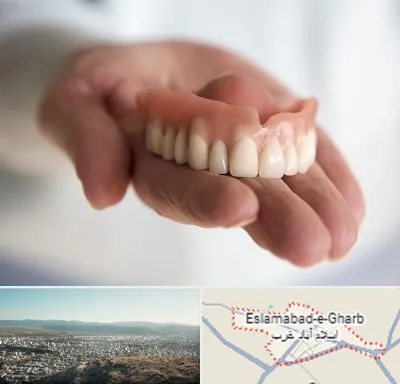 لیفت لثه با لیزر در اسلام آباد غرب