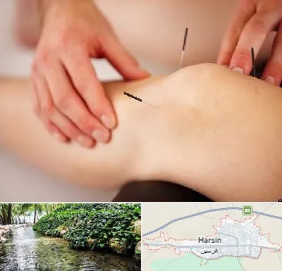 دکتر طب سوزنی برای لاغری در هرسین