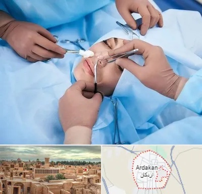 عمل بینی فانتزی در اردکان