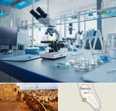 آزمایشگاه زگیل تناسلی در میبد