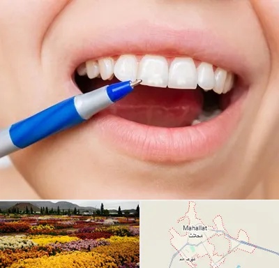 دندانسازی ارزان در محلات