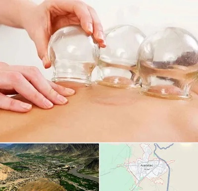 بادکش درمانی در اسدآباد