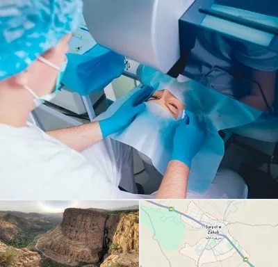 دکتر عمل لازک چشم در سرپل ذهاب