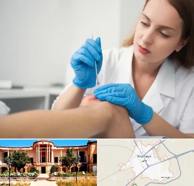 متخصص زخم در خمین