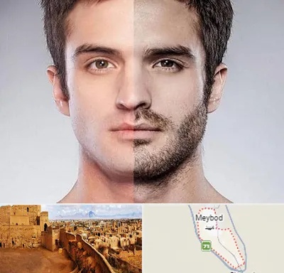 کاشت ریش و سبیل در میبد