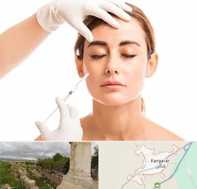 تزریق ژل گونه در کنگاور