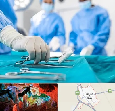مونس پلاستی در دلیجان