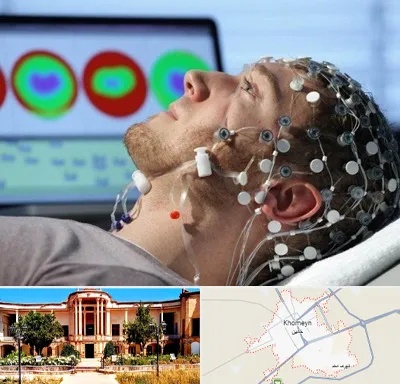 مرکز نوار مغز در خمین