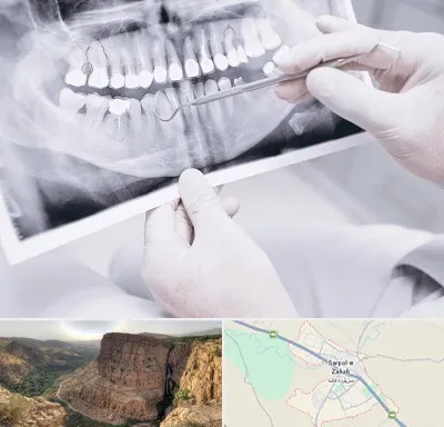 رادیولوژی دهان و دندان در سرپل ذهاب