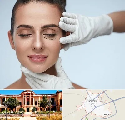 عمل پف چشم در خمین