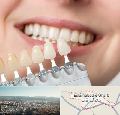 مرکز کامپوزیت دندان در اسلام آباد غرب