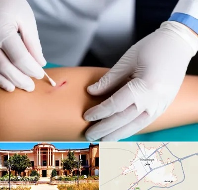 متخصص زخم عفونی در خمین