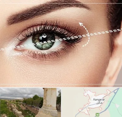 جراحی چشم گربه ای در کنگاور
