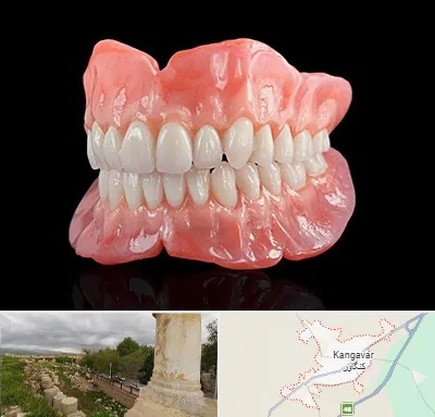 ساخت دندان مصنوعی در کنگاور