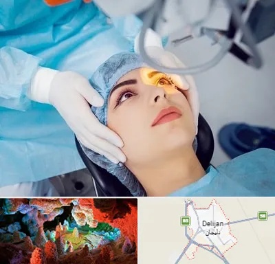 دکتر عمل لیزیک چشم در دلیجان