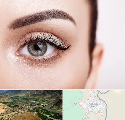فوق تخصص عنبیه در اسدآباد
