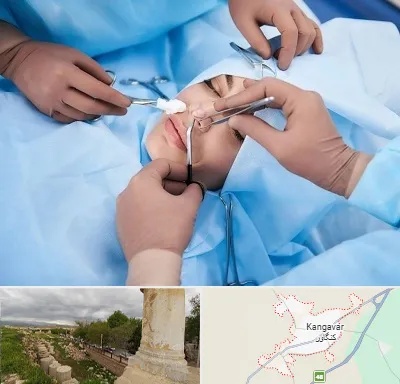 عمل بینی فانتزی در کنگاور